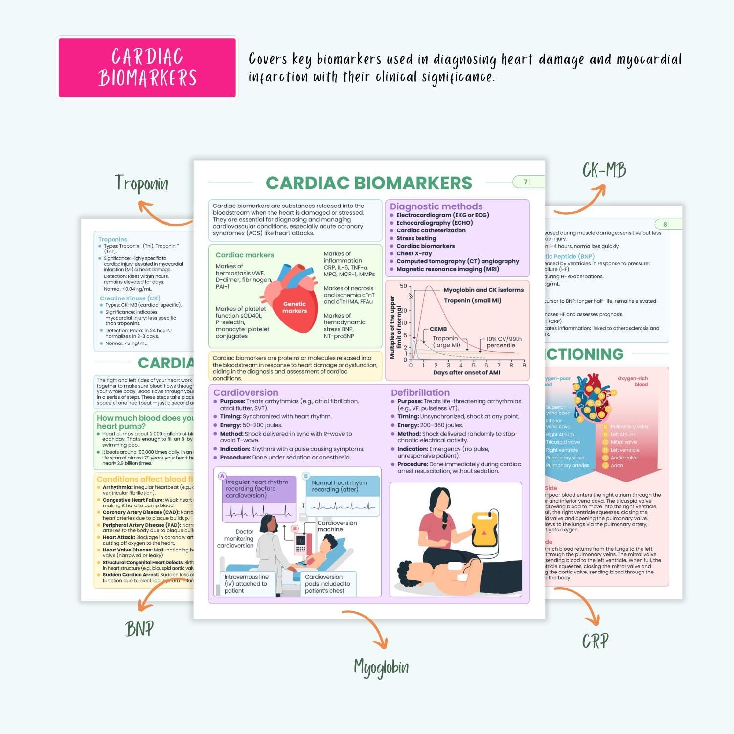 Cardiovascular Disorders Notes | 20+ Cardiac Conditions | ECG Heart Failure MI Angina Nursing